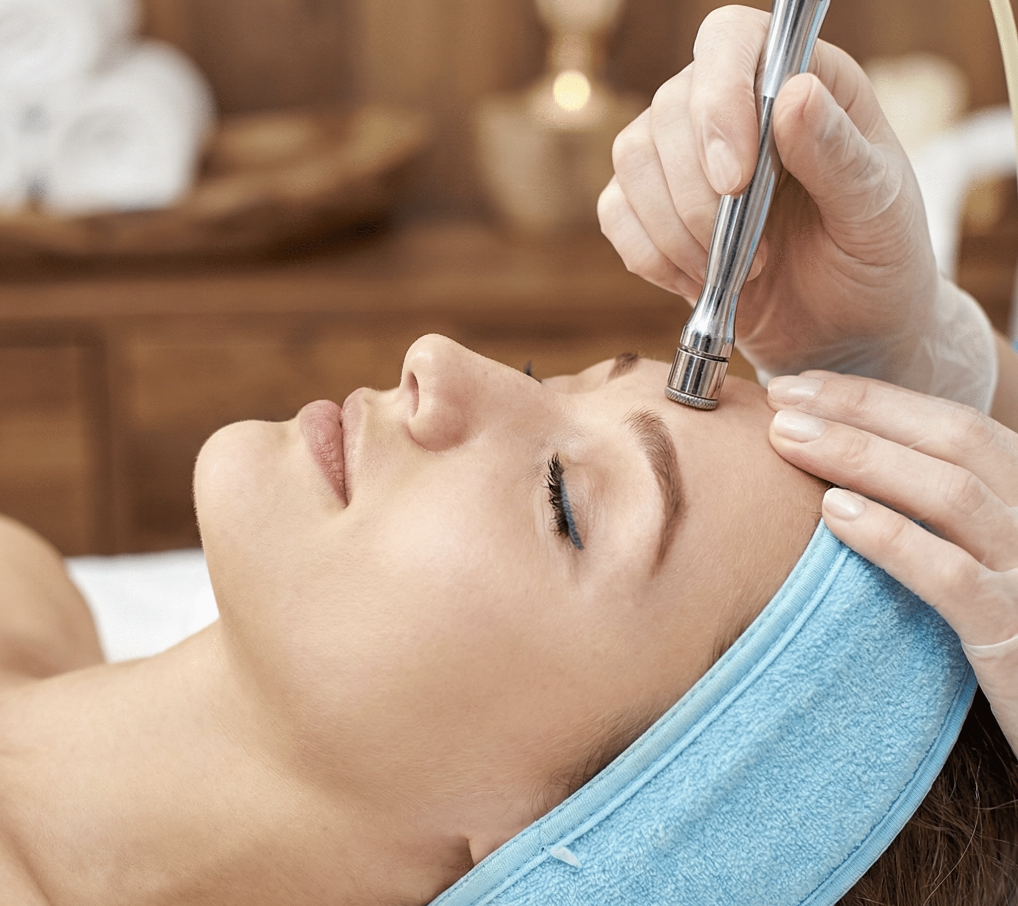 Microdermabrasion